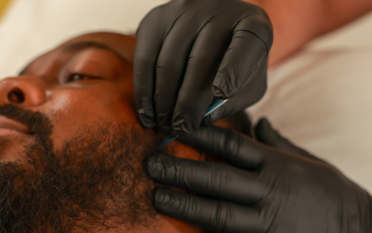 TMJ treatment options in Austin: manual therapy, dry needling and Botox